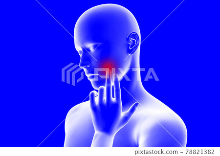 CG illustration of a person with tooth decay pain 78821382