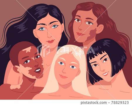 Portrait of young women with different skin types. 78829323
