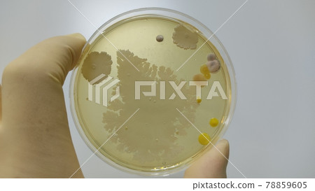 Quality control microbiological test mold culture results 78859605