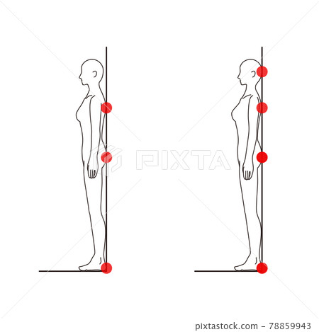 Female medical posture (straight neck check) beauty naked nude whole body side Female medical posture (straight neck check) beauty naked nude whole body side 78859943