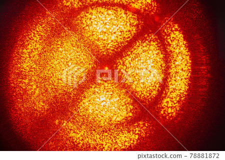 birefringence phenomena 78881872