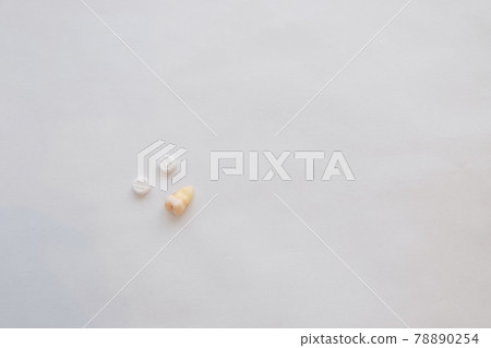 Wisdom tooth extraction Wisdom tooth extraction 78890254