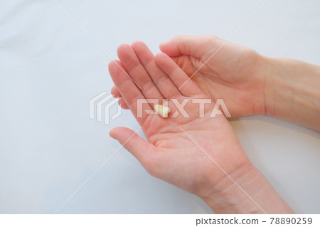 Wisdom tooth extraction Wisdom tooth extraction 78890259