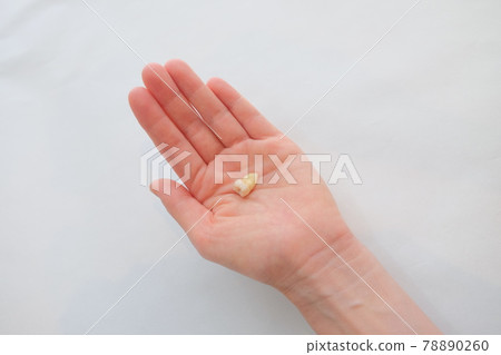 Wisdom tooth extraction 78890260