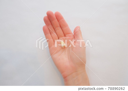 Wisdom tooth extraction Wisdom tooth extraction 78890262