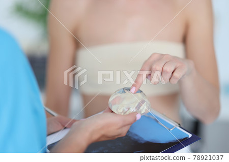 Woman is examining silicone implant for breast augmentation by touch 78921037