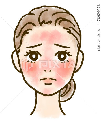 一個患有紅腫的女人的臉插圖 一個患有紅腫的女人的臉插圖 78924678