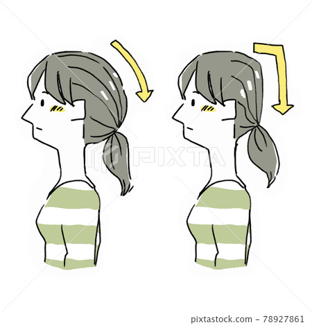 正常形狀的枕骨區和懸崖枕骨區的插圖 78927861