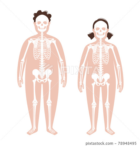 Obese skeleton anatomy Obese skeleton anatomy 78948495