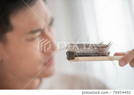 man worry about hair loss 78954492