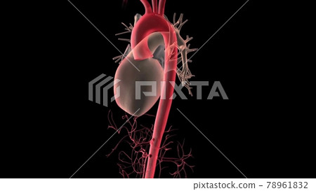 Abdominal aorta, Rupture of an abdominal aortic aneurysm Abdominal aorta, Rupture of an abdominal aortic aneurysm 78961832