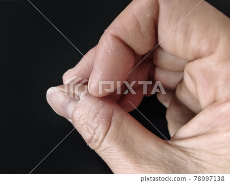 剝開你的手指 78997138