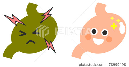 健康和不健康的胃的插圖 健康和不健康的胃的插圖 78999498