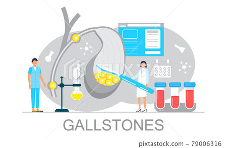 Gallbladder concept vector. Doctors treat gallstones. Web, landing page 79006316