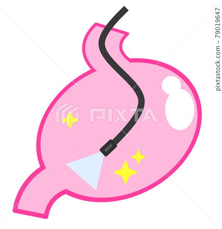 Illustration of performing a detailed examination using a gastrocamera in a health examination 79019647