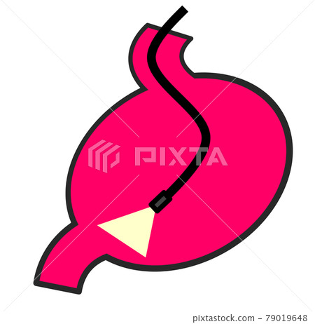 Illustration of performing a detailed examination using a gastrocamera in a health examination 79019648