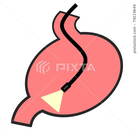Illustration of performing a detailed examination using a gastrocamera in a health examination 79019649