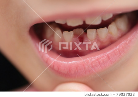 從乳牙再生到恆牙 從乳牙再生到恆牙 79027028