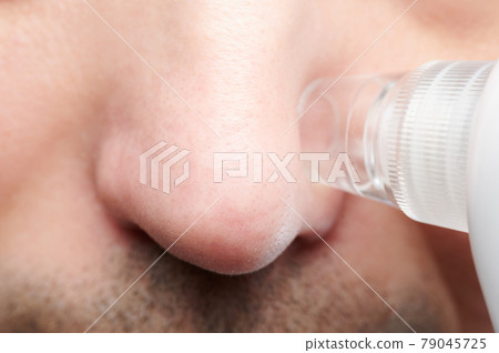 Skin treatment procedure 79045725