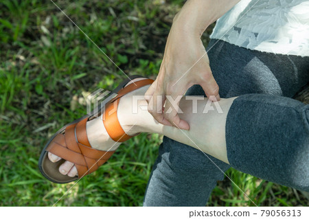 A woman scratching her leg bitten by an insect 79056313