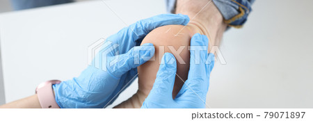 Doctor dermatologist in gloves examining patients heel closeup 79071897