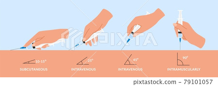 Types injections. Guide to injecting vaccines into skin. Hands holds syringes at different angles. Doctors arms vaccinate patients. Vector medical procedure manuals for hospital workers Types injections. Guide to injecting vaccines into skin. Hands holds syringes at different angles. Doctors arms vaccinate patients. Vector medical procedure manuals for hospital workers 79101057