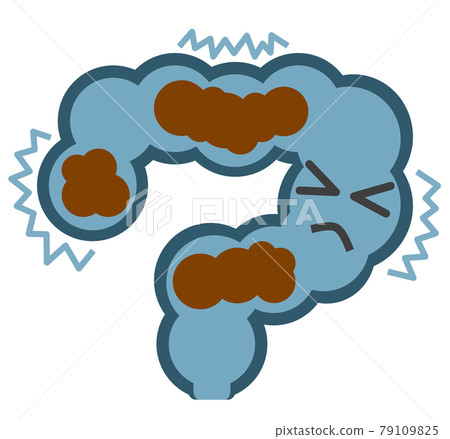 Illustration of the large intestine that makes my stomach hurt due to constipation 79109825