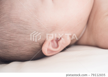 嬰兒耳瘺 79112835