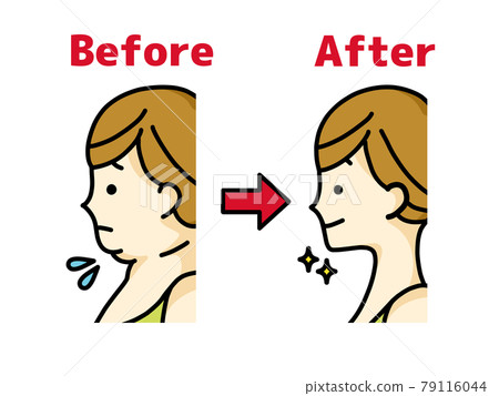 Double chin woman and slim face line woman 79116044