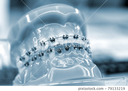 Braces on artificial teeth close-up, dental tooth dentistry. Braces on artificial teeth close-up, dental tooth dentistry. 79133219