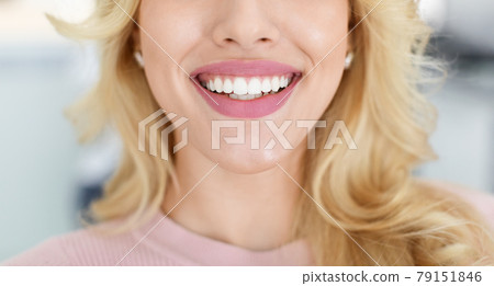 Blonde lady showing beautiful white teeth, cropped Blonde lady showing beautiful white teeth, cropped 79151846