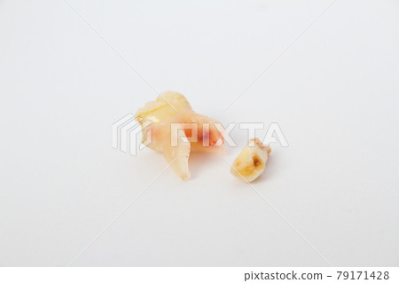 拔出來的乳牙 79171428