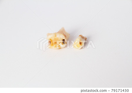 拔出來的乳牙 79171430