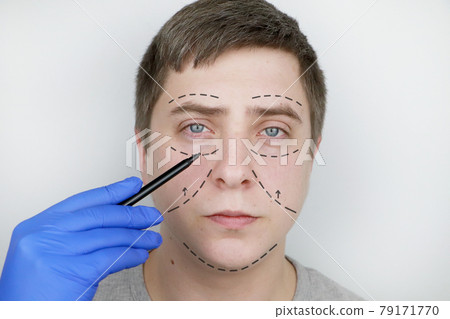 A man at the reception at the plastic surgeon. Before plastic surgery: eyebrow, forehead, chin and cheek lift A man at the reception at the plastic surgeon. Before plastic surgery: eyebrow, forehead, chin and cheek lift 79171770