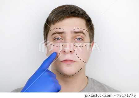 A man at the reception at the plastic surgeon. Before plastic surgery: eyebrow, forehead, chin and cheek lift A man at the reception at the plastic surgeon. Before plastic surgery: eyebrow, forehead, chin and cheek lift 79171779