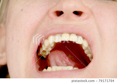 The hole in the tooth and the treatment of dental canals. Treatment of periodontitis in the dental clinic 79171784