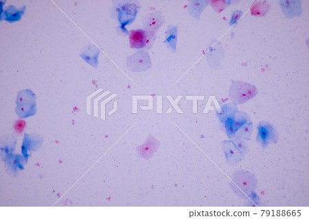 Characteristics of anatomy and Histological sample Squamous epithelial cells under microscope, Human and isolated Cell. Characteristics of anatomy and Histological sample Squamous epithelial cells under microscope, Human and isolated Cell. 79188665