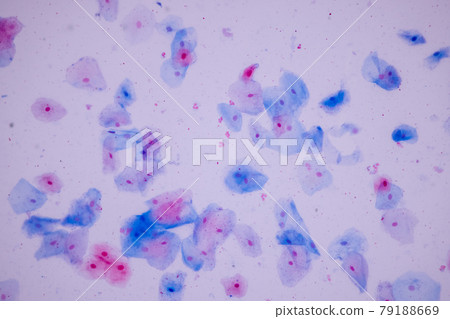 Characteristics of anatomy and Histological sample Squamous epithelial cells under microscope, Human and isolated Cell. Characteristics of anatomy and Histological sample Squamous epithelial cells under microscope, Human and isolated Cell. 79188669