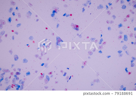 Characteristics of anatomy and Histological sample Squamous epithelial cells under microscope, Human and isolated Cell. Characteristics of anatomy and Histological sample Squamous epithelial cells under microscope, Human and isolated Cell. 79188691