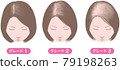 Female androgenetic alopecia, Ludwig classification, grade notation 79198263
