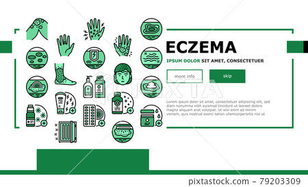 Eczema Disease Treat Landing Header Vector Eczema Disease Treat Landing Header Vector 79203309