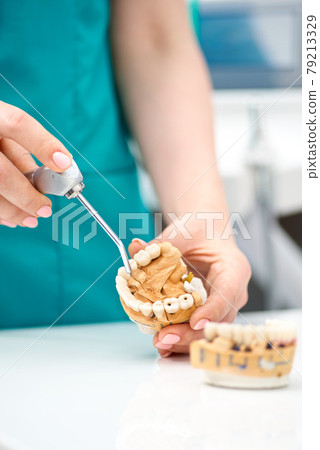 The dentist's hand holds an artificial jaw mock-up and shows the patient's teeth. Treatment in a dental clinic. Close-up. 79213329