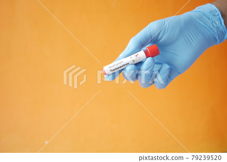 hand in blue medical gloves holding blood test tube against orange background  79239520