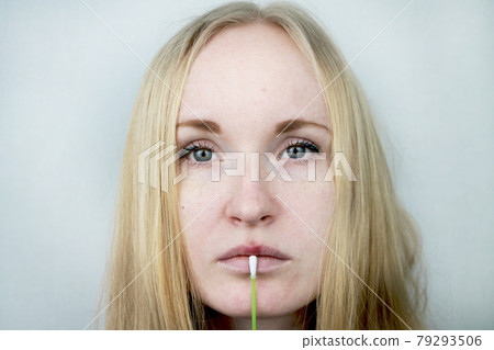 Beautiful young woman, lips infected with herpes virus. The concept of treatment of the herpes virus Beautiful young woman, lips infected with herpes virus. The concept of treatment of the herpes virus 79293506
