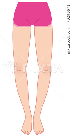 Leg distortion crab crotch 79296671