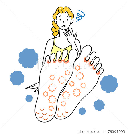 護膚 可愛的女人，因為她的腳是運動員的腳而感到悲傷 向上她腳底的插圖矢量 79305093