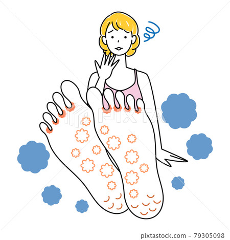 Skin care Cute woman who is sad because her feet are athlete's foot Up illustration vector of the soles of her feet Skin care Cute woman who is sad because her feet are athlete's foot Up illustration vector of the soles of her feet 79305098