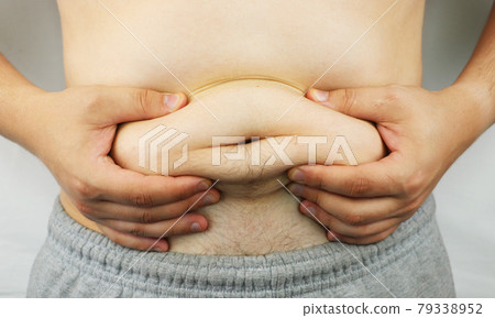 A doctor examines a man, a medical device. The concept of obesity and obesity A doctor examines a man, a medical device. The concept of obesity and obesity 79338952