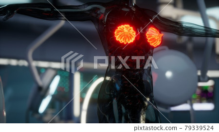 medical scan of Woman Breast 79339524