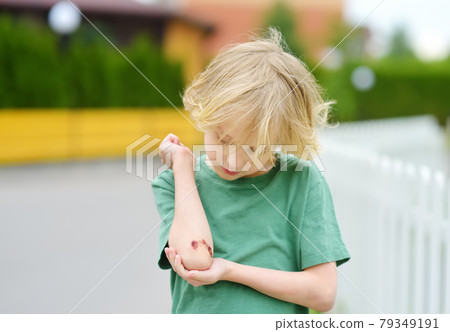 Cute little boy looking on his elbow with wound. Child healthcare and medicine concept. First aid. Cute little boy looking on his elbow with wound. Child healthcare and medicine concept. First aid. 79349191